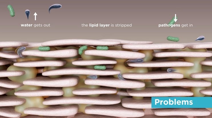 Atlantik Body Ireland Care Skin Problems Animation, Natural Skin Care