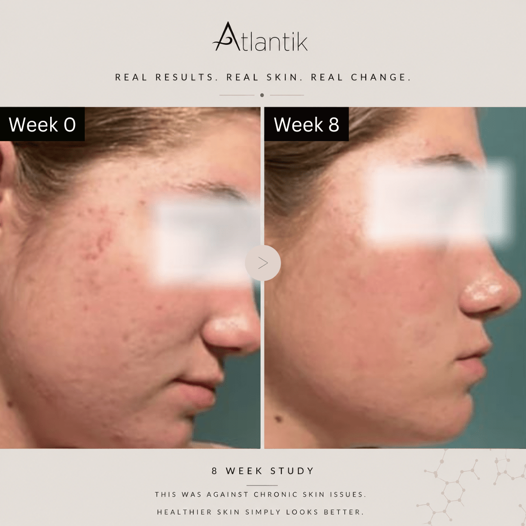 Real Results: 8-Week Atlantik Body Care Study