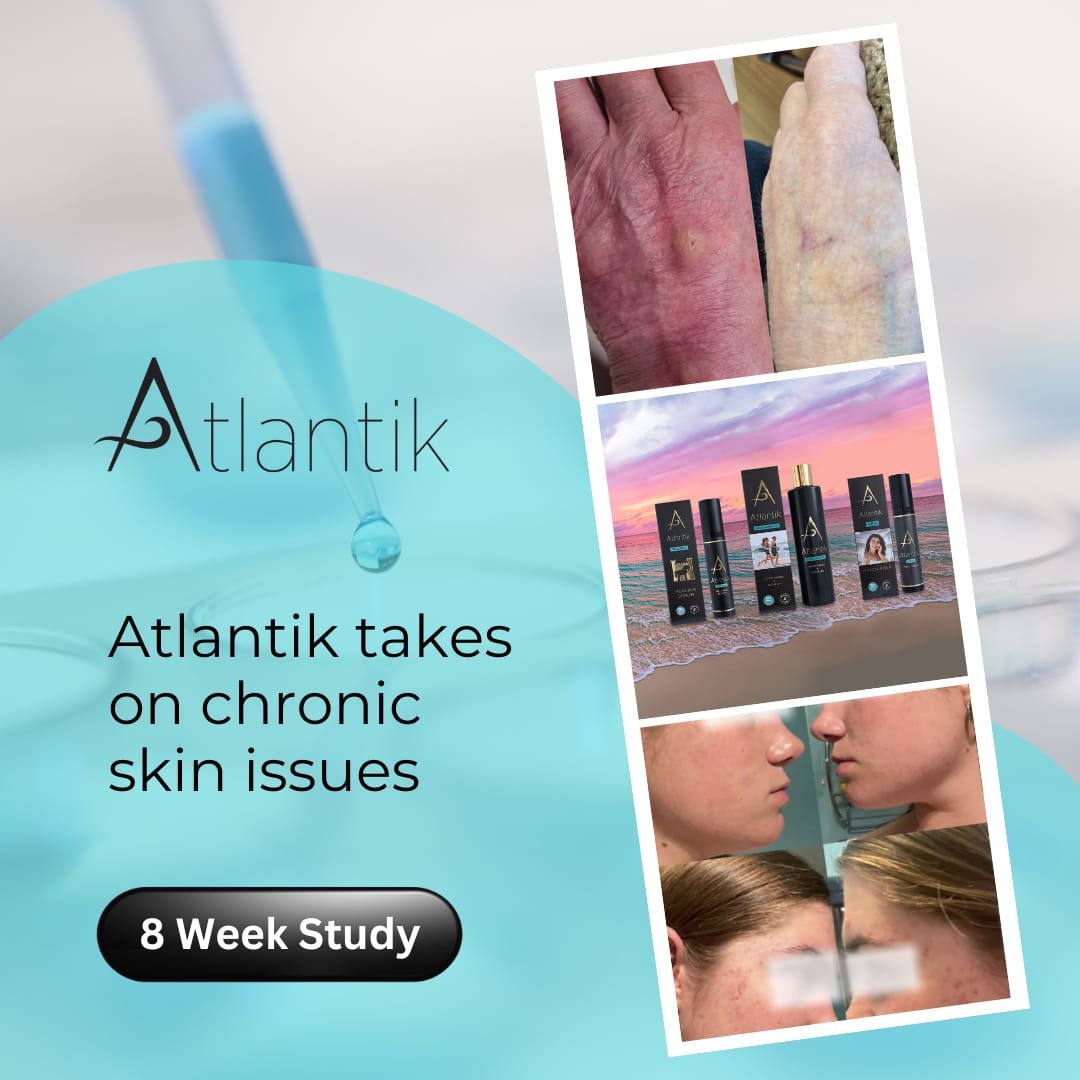 8-Week In-House Study on Skin Health Outcomes in Ireland (2025)